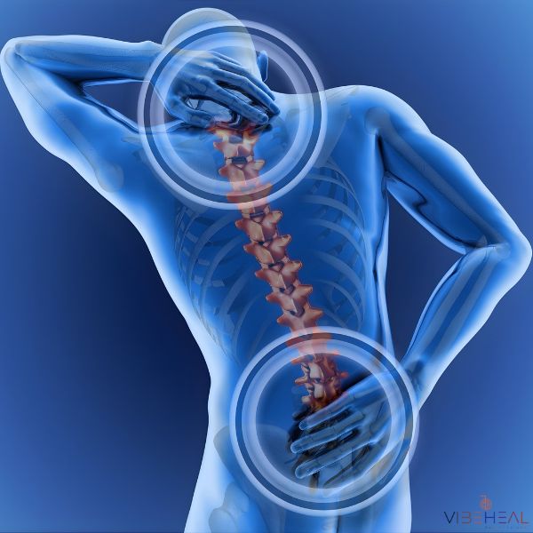 Illustration médicale montrant une personne se tenant la nuque et le bas du dos, avec la colonne vertébrale mise en évidence pour représenter les douleurs dorsales.